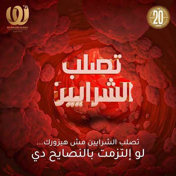تصلب الشرايين