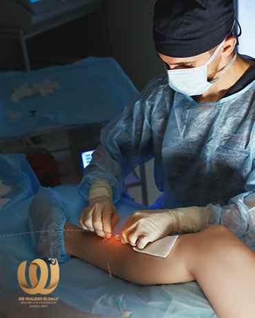 Advantages - Laser - Varicose Veins - Varicose-Leg veins -Treatment