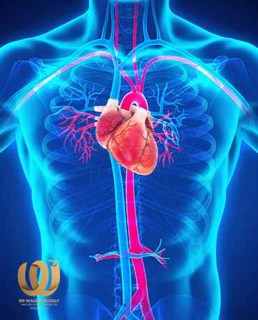 Aortic aneurysm