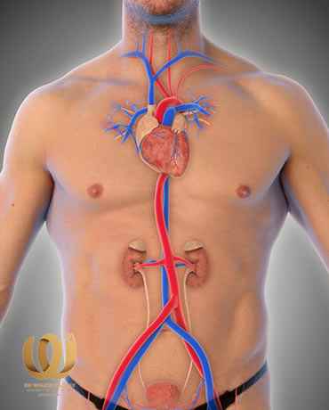 Ways to treat aortic aneurysm