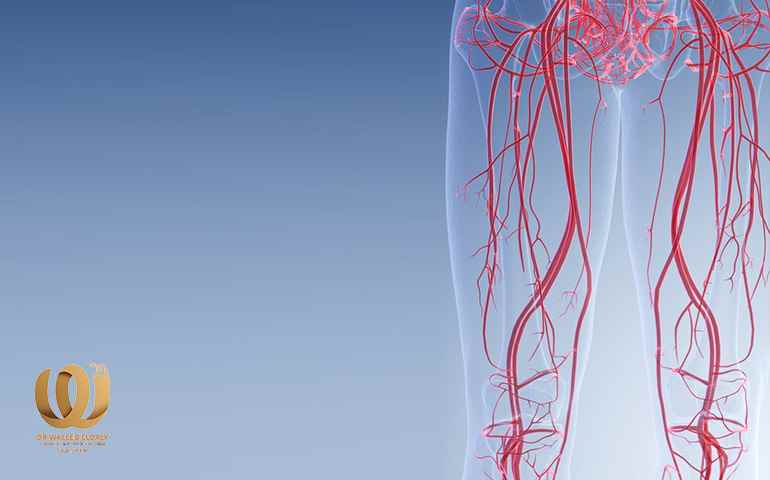 Peripheral arterial occlusion